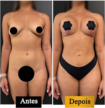 ANTES E DEPOIS 01
