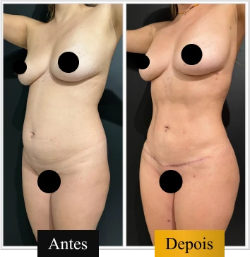 ANTES E DEPOIS 02