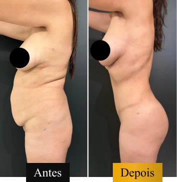 ANTES E DEPOIS 03