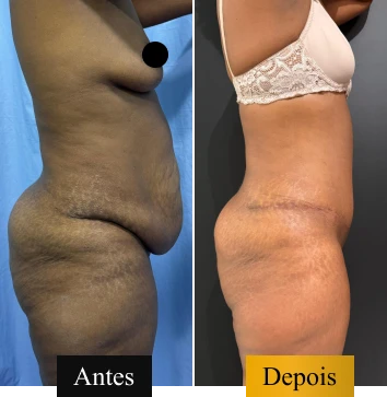 ANTES E DEPOIS 04