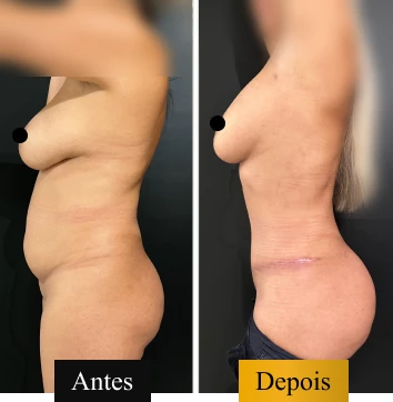 ANTES E DEPOIS 05