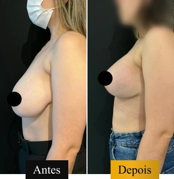 antes_e_depois_07 (1)